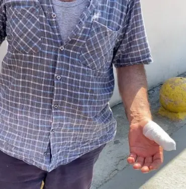 BU BAYRAM DA MANZARA DEĞİŞMEDİ, KURBANLIK YERİNE KENDİLERİNİ KESTİLER ACEMİ KASAPLAR HASTANELİK OLDU