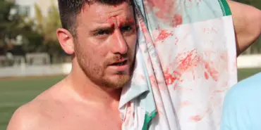 Halim Günel sahadan bu şekilde çıkabildi (1)