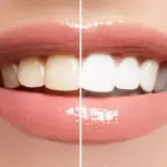 dis-