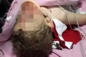 SAMSUN'DA 4. KATIN PENCERESİNDEN DÜŞEN ÇOCUK AĞIR YARALANDI