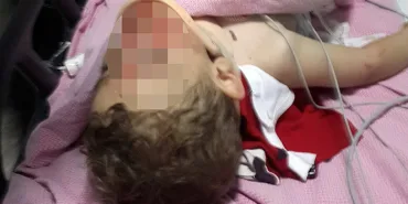 SAMSUN'DA 4. KATIN PENCERESİNDEN DÜŞEN ÇOCUK AĞIR YARALANDI