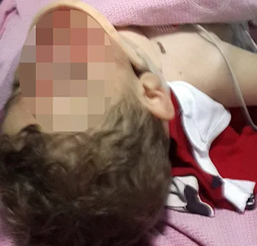 SAMSUN'DA 4. KATIN PENCERESİNDEN DÜŞEN ÇOCUK AĞIR YARALANDI