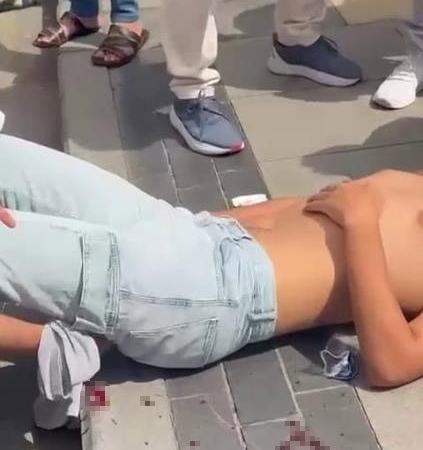 CUMA NAMAZI KILDIĞI ESNADA KALÇASINDAN BIÇAKLANDI