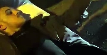 KAZADA YARALANDI, YERDE YATARKEN TELEFONUNU ELİNDEN BIRAKMADI