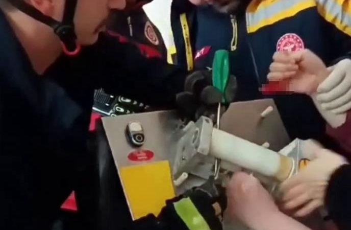 Yurtta öğrencilere lahmacun yaparken parmağını hamur makinasına kaptırdı