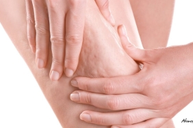 selülit-tedavisi_095925851