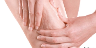 selülit-tedavisi_095925851