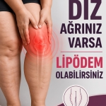 lipödem_095741977