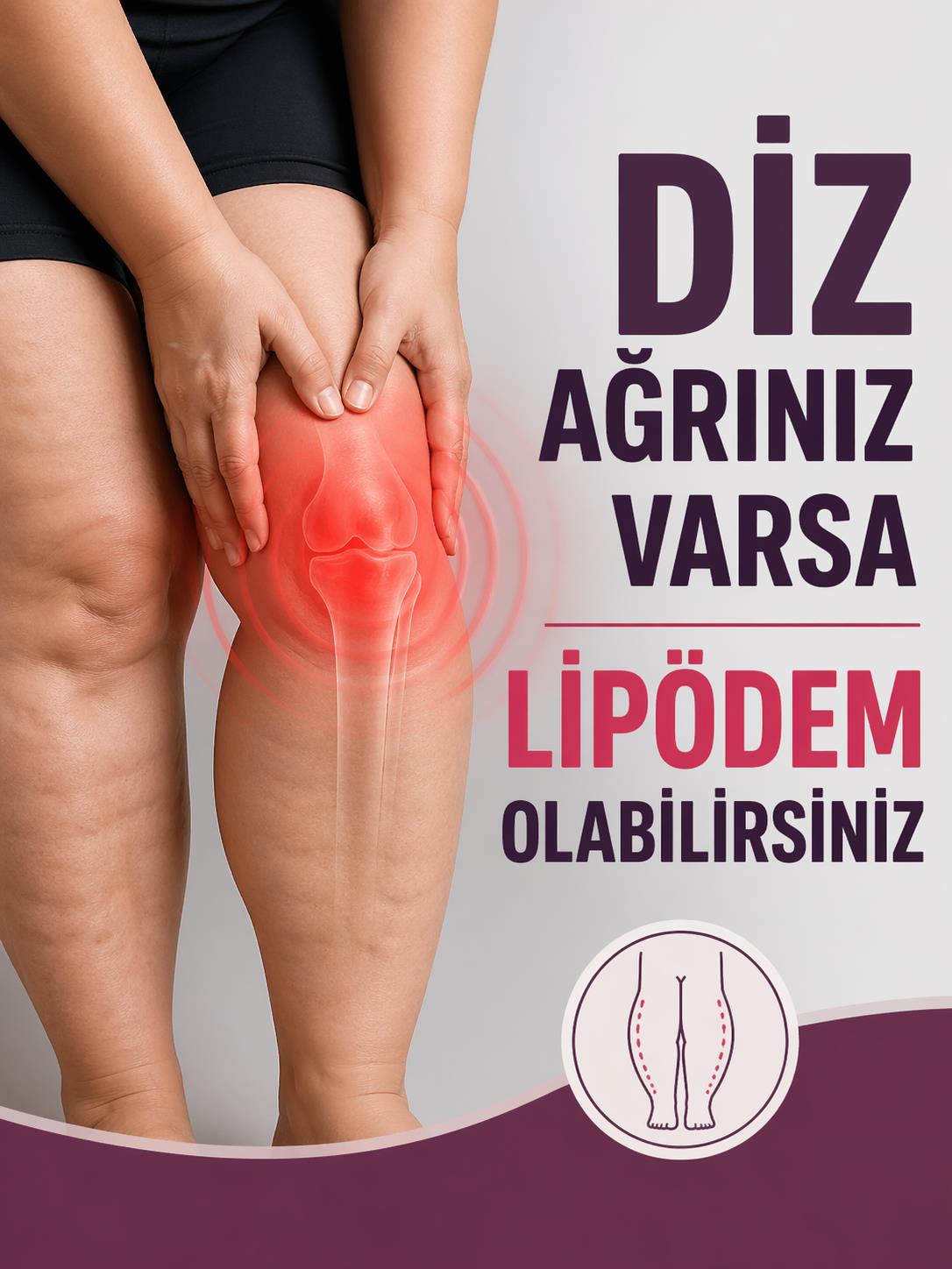 lipödem_095741977