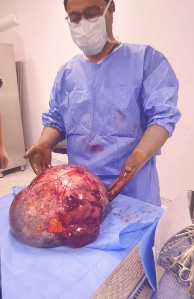 14 kiloluk tümör ameliyatı sonrası dikkat çeken iyileşme hikâyesi